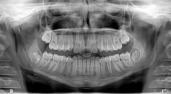 Dlaczego powinniśmy stawiać tylko na profesjonalne gabinety ortodontyczne?